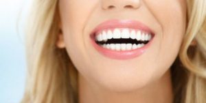 Sbiancamento dentale
