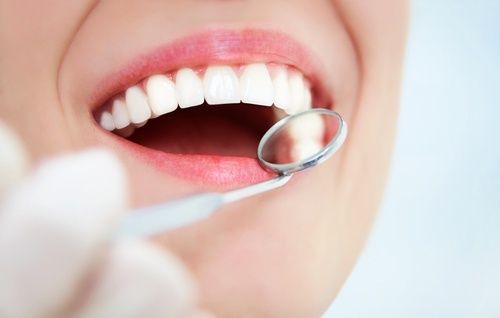 Denti del giudizio: che cosa sono e perché nascono