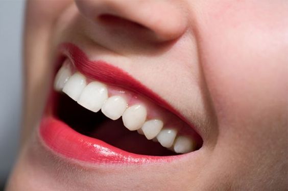Pulizia dei denti: perché rivolgersi a un professionista